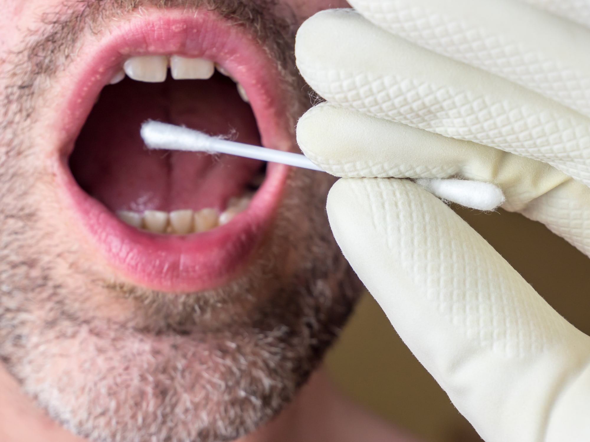 Forensic DNA Litigation 2 DNA test swab saliva sample